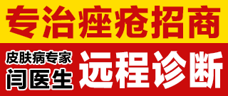 善积闫医生皮肤病系列药